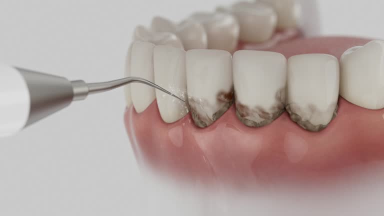 Reliable Dental Implants contractor in Morris, MN by Smile Center Dentistry
